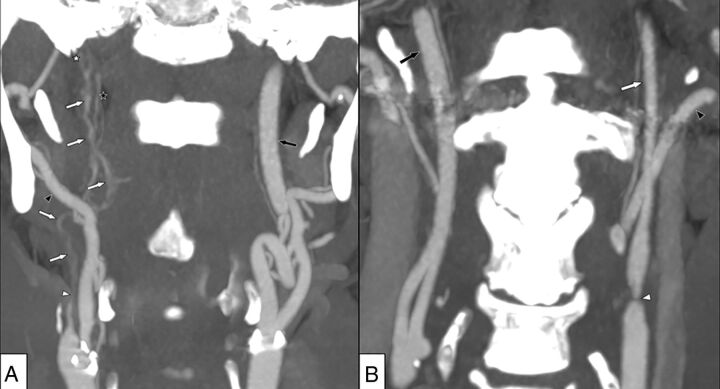 Fig 1.