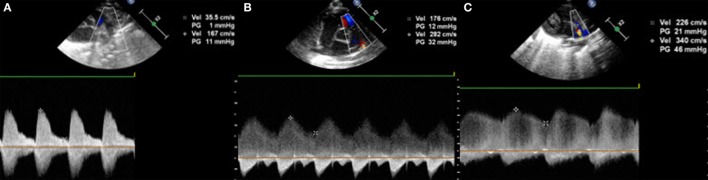 Figure 10