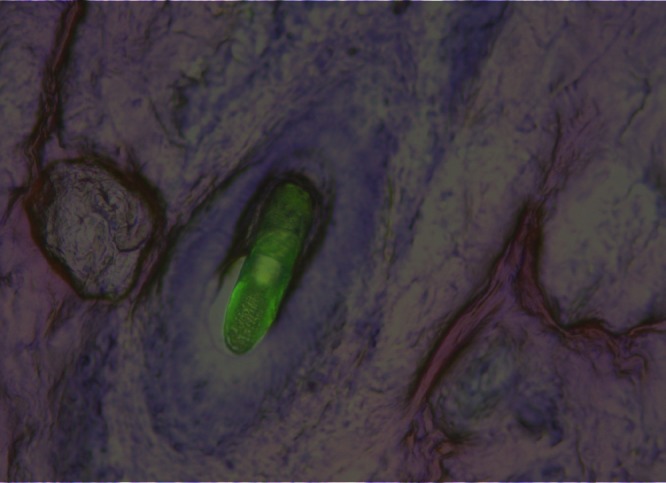 Fig. 2