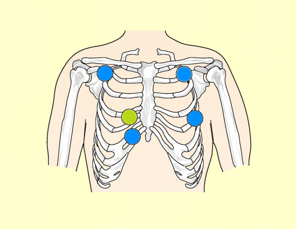 graphic file with name 6376_9_De_42_Fig3_HTML.jpg