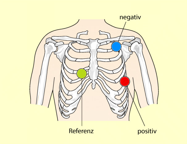 graphic file with name 6376_9_De_42_Fig2_HTML.jpg
