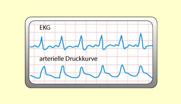 graphic file with name 6376_9_De_42_Fig7_HTML.jpg