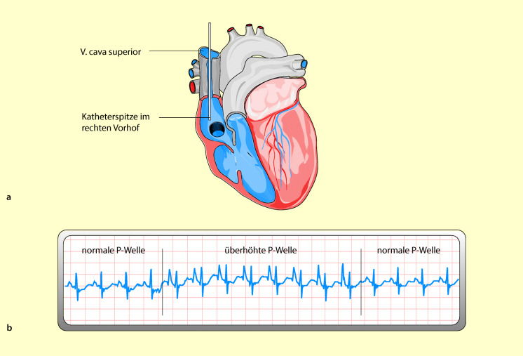 graphic file with name 6376_9_De_42_Fig11_HTML.jpg