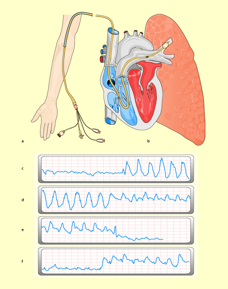 graphic file with name 6376_9_De_42_Fig14_HTML.jpg