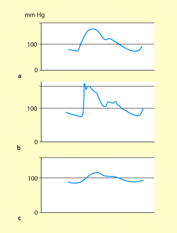 graphic file with name 6376_9_De_42_Fig8_HTML.jpg