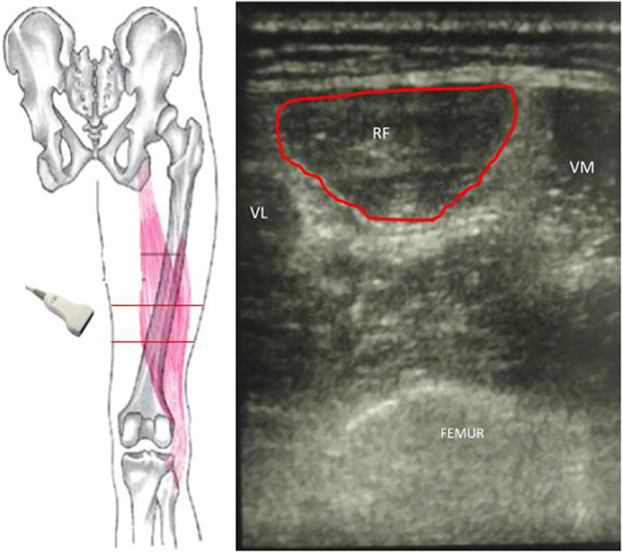 Fig. 2