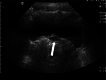 Fig. 12