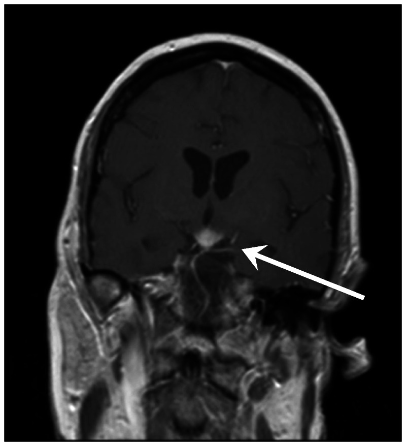 Figure 2-8.