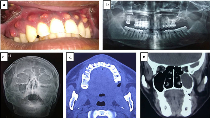 Fig. 4