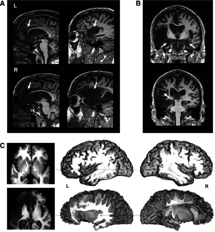 Fig. 1