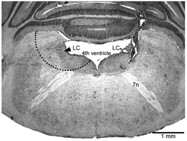 Fig. 1