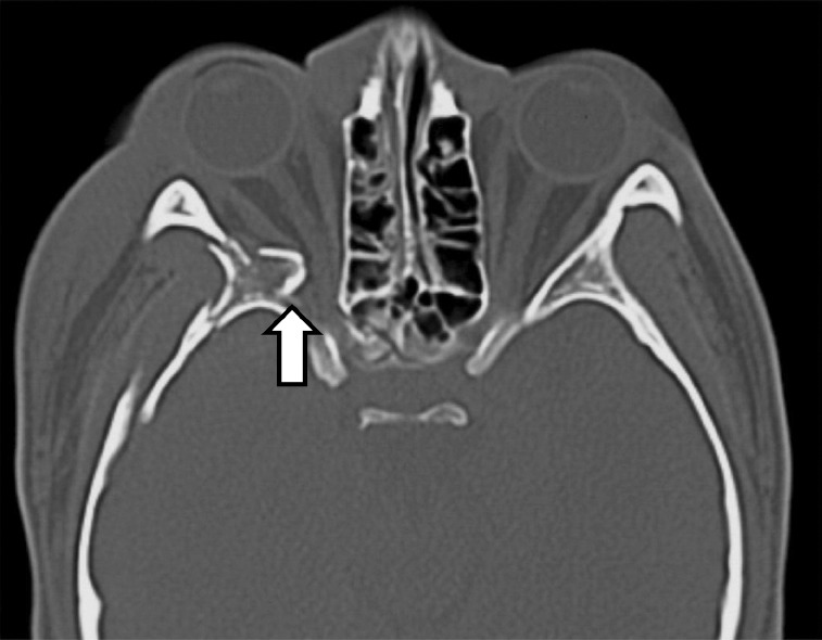 Fig. 5