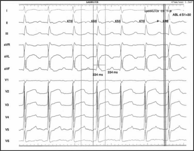 Figure 1: