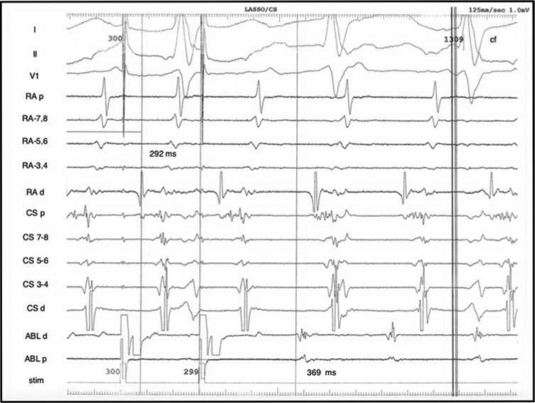 Figure 4: