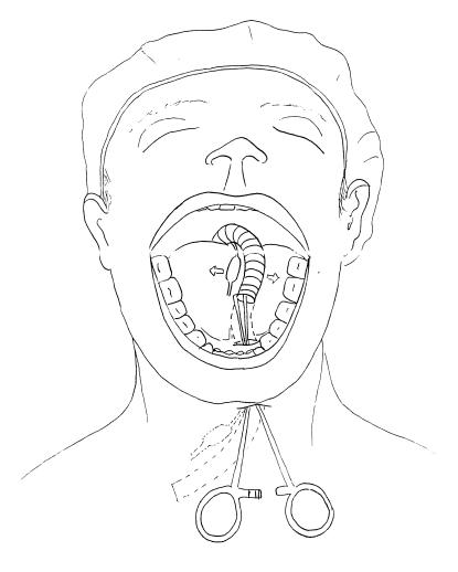 Figure 8A