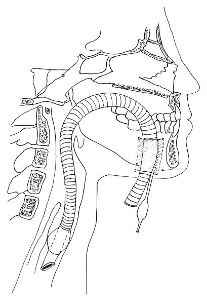 Figure 8B