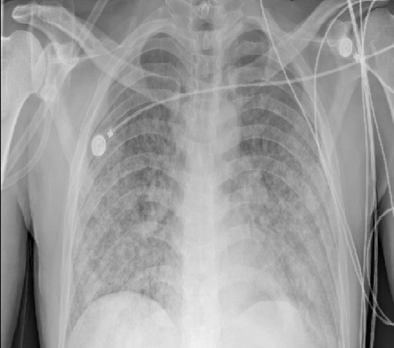 Fig. 3
