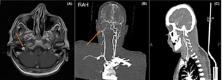 FIGURE 3