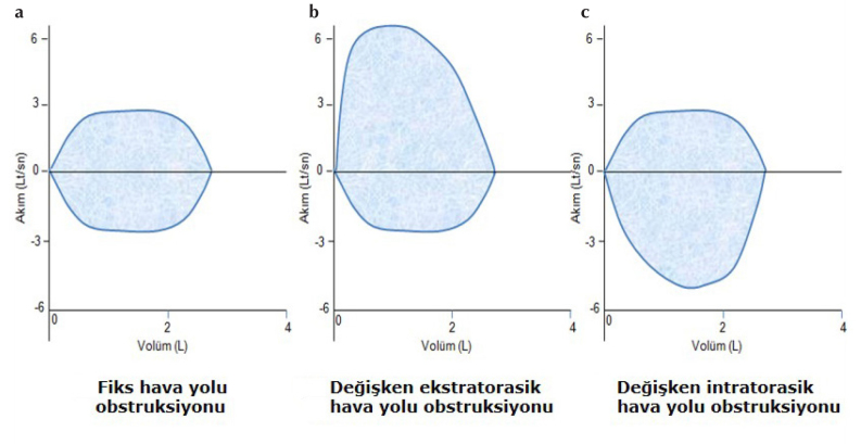 Şekil 10. a–c