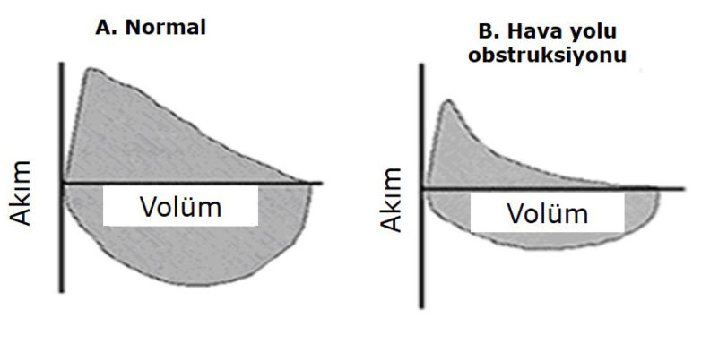 Şekil 15. a, b