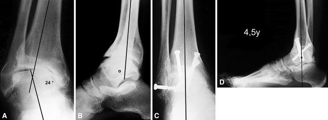 Fig. 6A–D