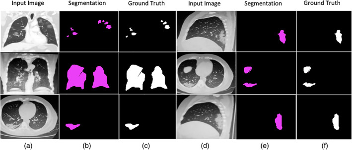 FIGURE 12