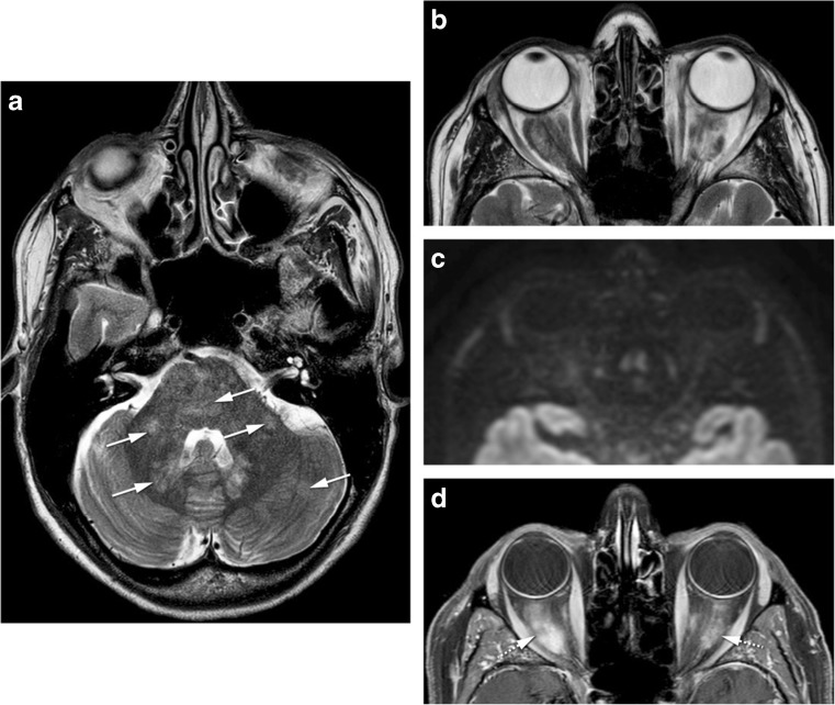 Fig. 12