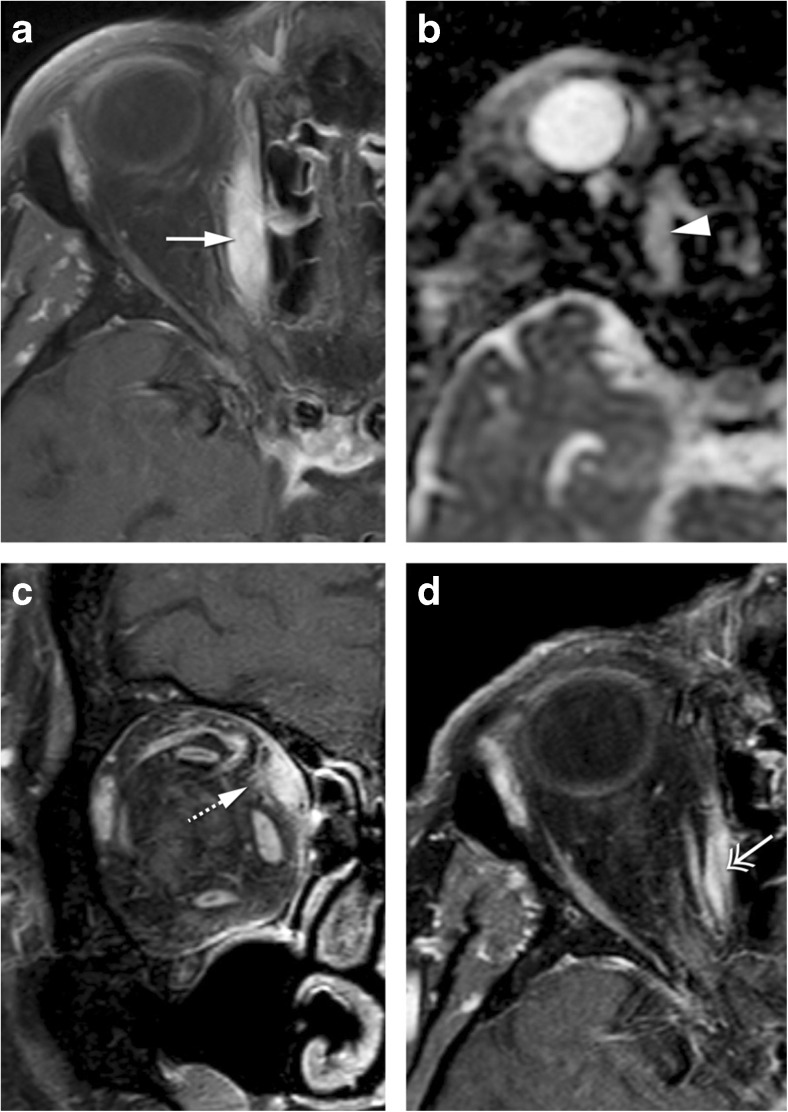 Fig. 5