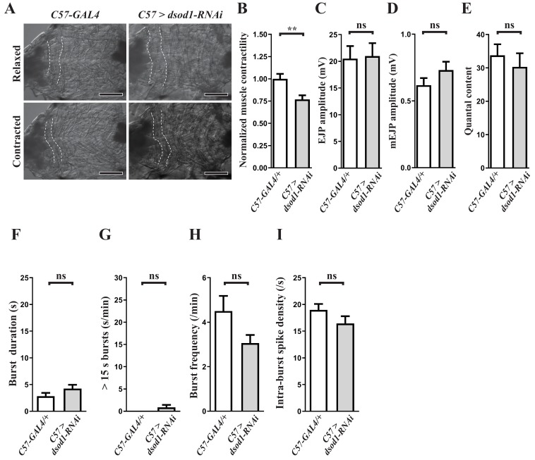 Figure 6—figure supplement 1.