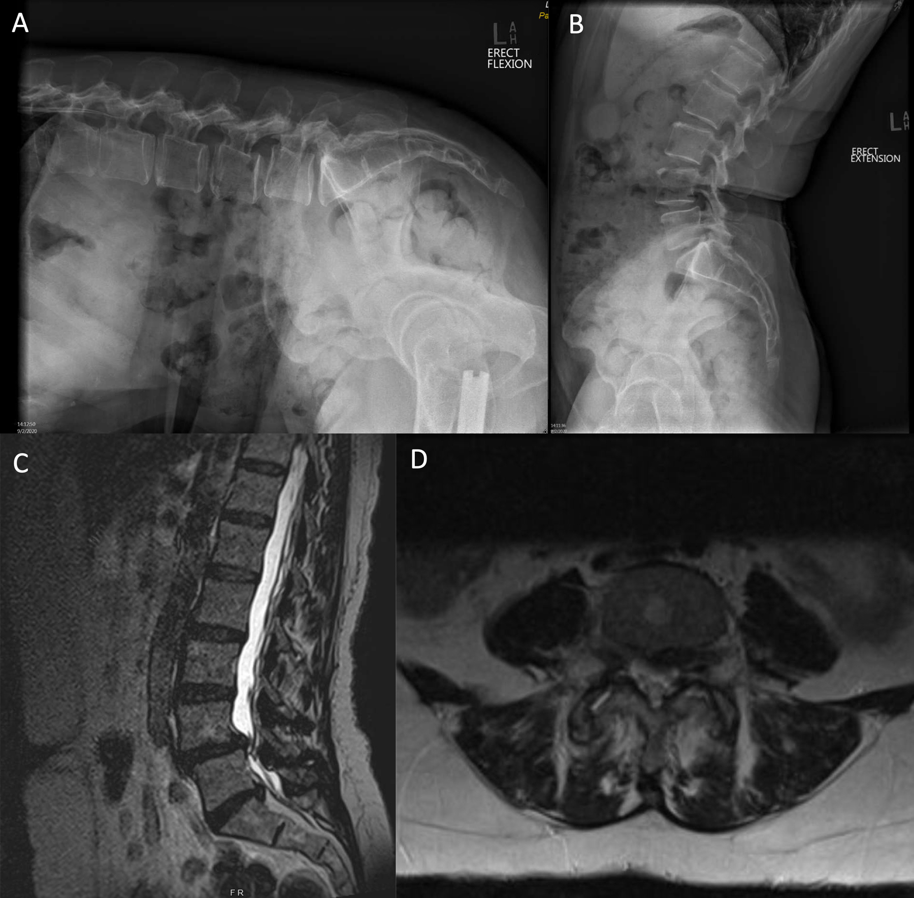 Fig 4.