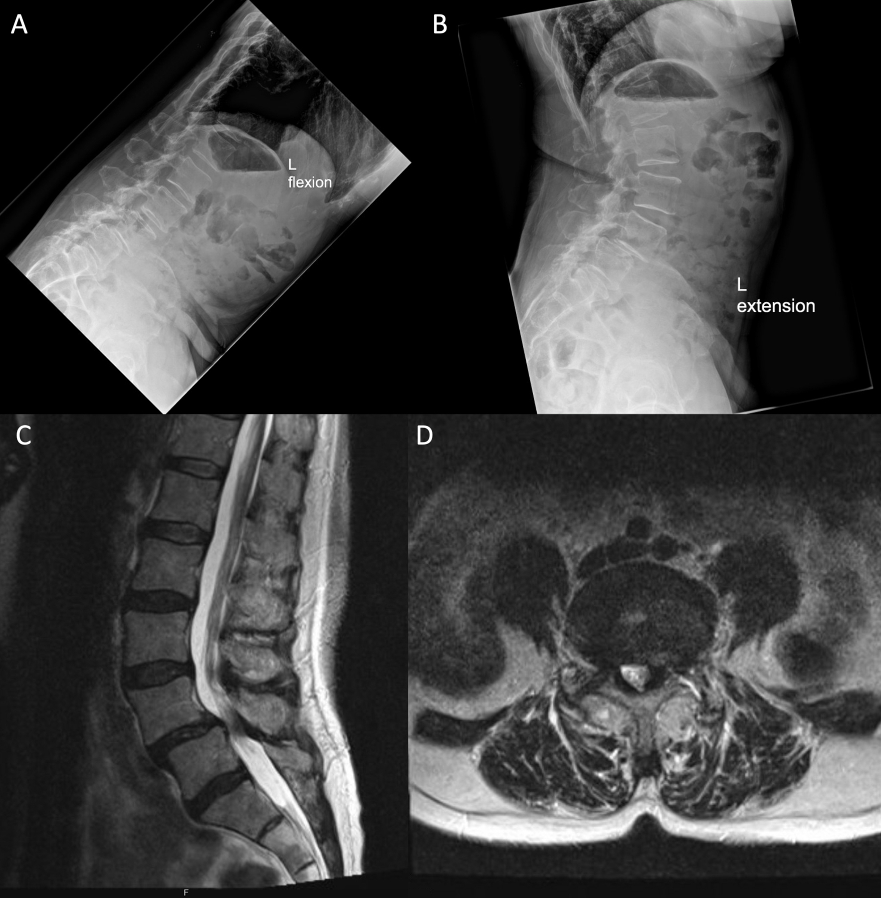 Fig 2.
