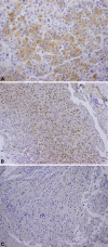 Fig. 1A–C