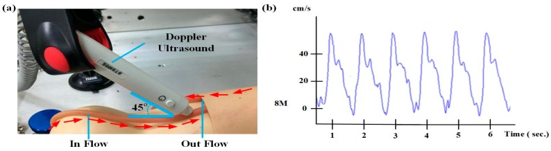 Figure 12