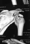 Fig. 3