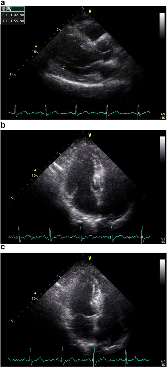 Fig. 2