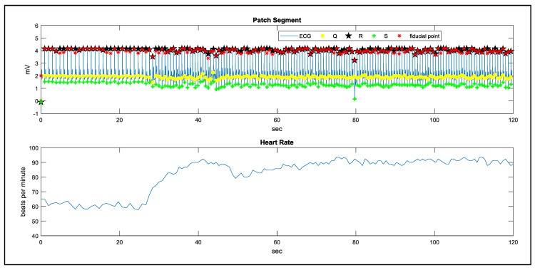 Figure 20