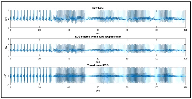 Figure 18