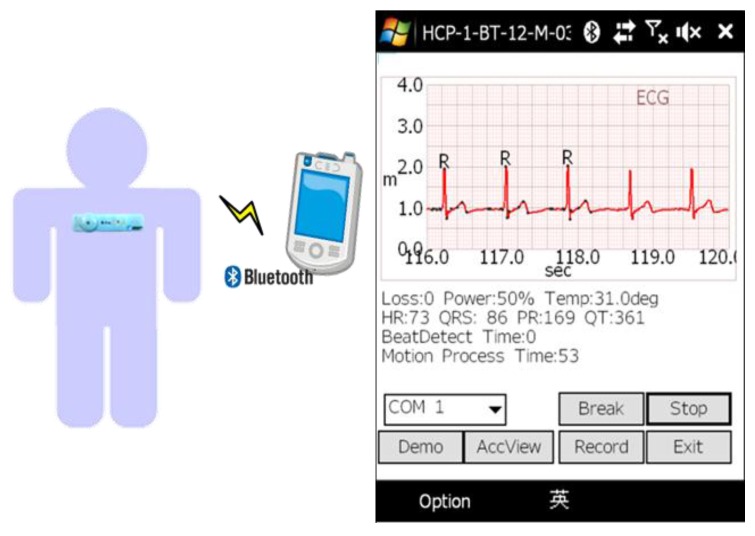 Figure 14