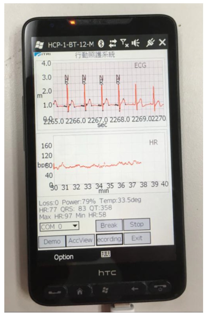 Figure 15