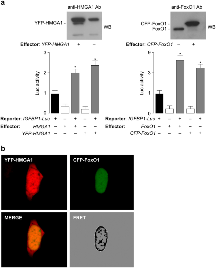 Cross-talk among HMGA1 and FoxO1 in control of nuclear insulin ...