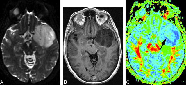 Fig 3.