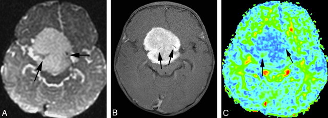 Fig 2.