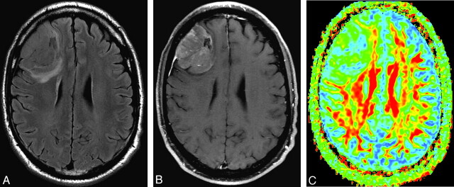 Fig 4.