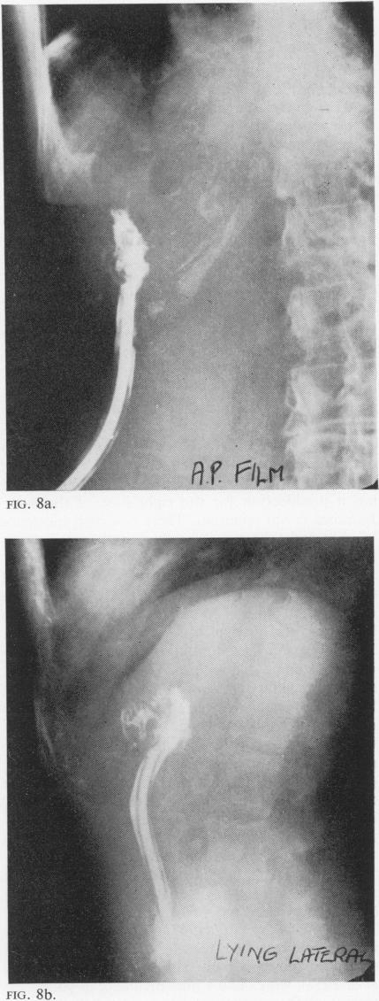 FIG. 8