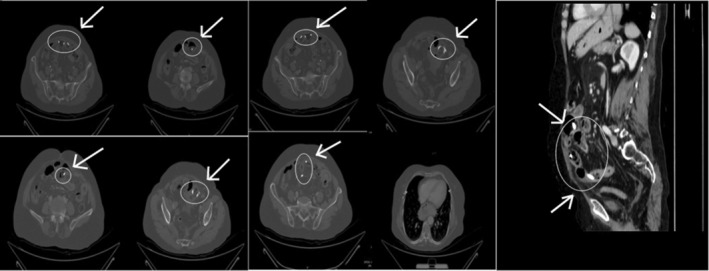FIGURE 3