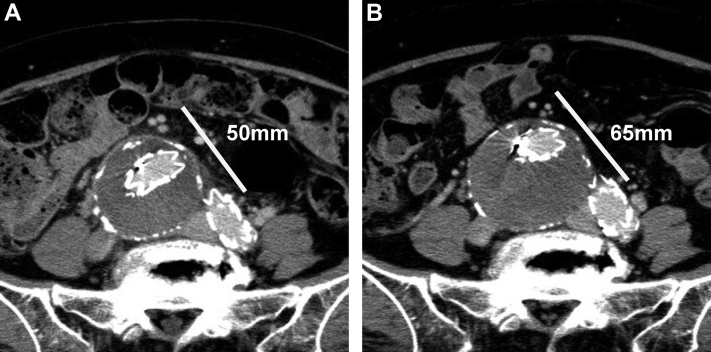 Fig 1