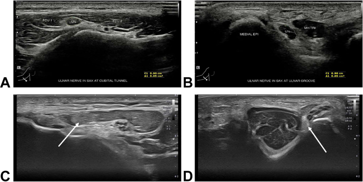 Figure 11