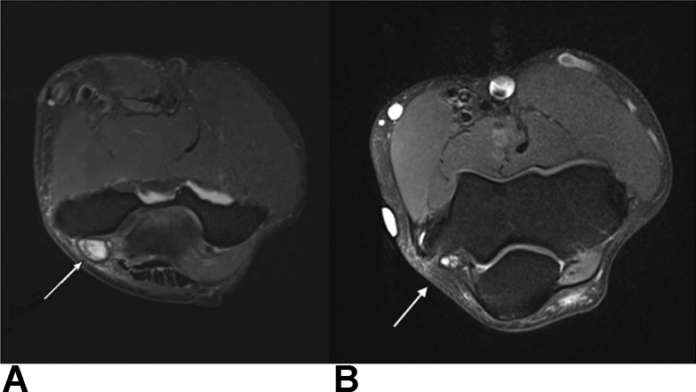 Figure 12