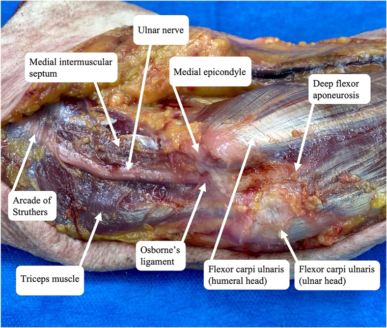 Figure 1