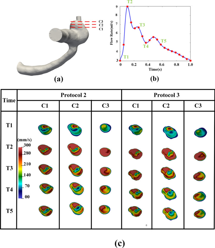 Fig. 12